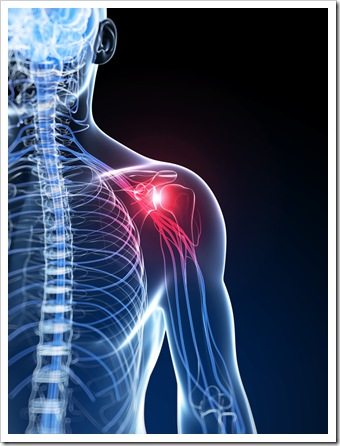 Shoulder Pain Albuquerque NM Rotator Cuff Syndrome